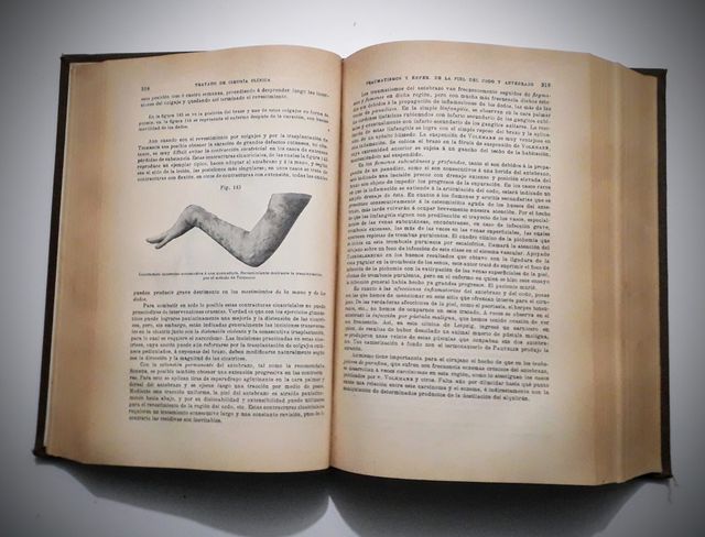 TRATTATO DI CHIRURGIA CLINICA E OPERATIVA