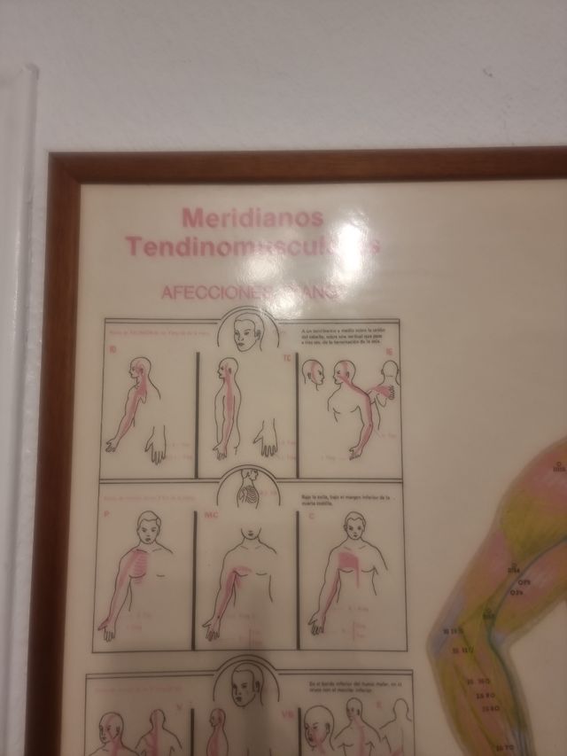 Cuadro de meridianos acupuntura