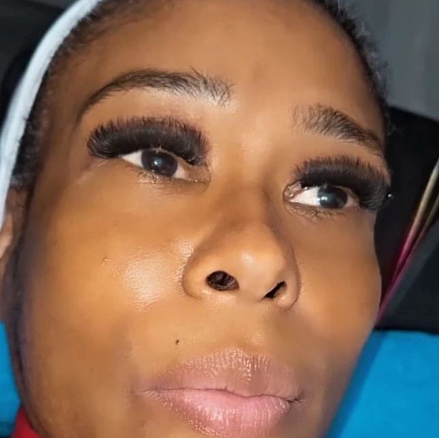 Pestañas y microblanding