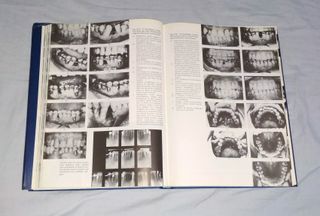 Libro "Atlas de ortodoncia del adulto" (1992)