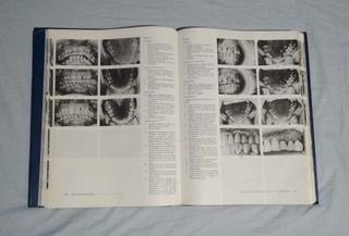 Libro "Atlas de ortodoncia del adulto" (1992)