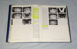 Libro "Atlas de ortodoncia del adulto" (1992)