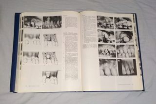 Libro "Atlas de ortodoncia del adulto" (1992)