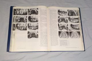 Libro "Atlas de ortodoncia del adulto" (1992)