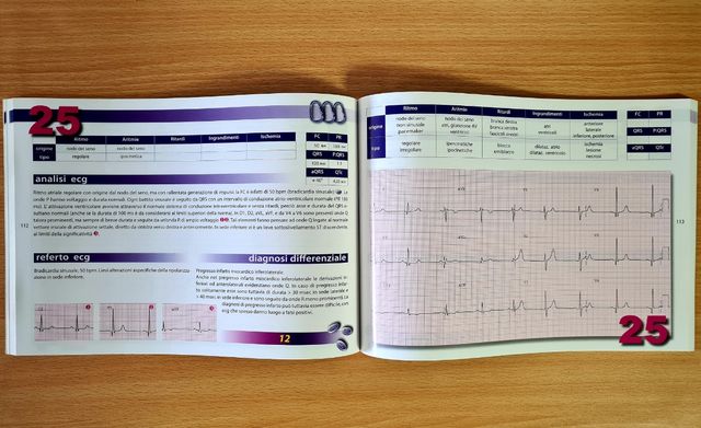 L'ABC dell'ECG Elettrocardiogramma