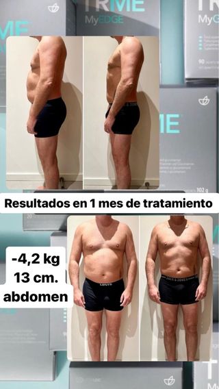 Asesoramiento facial gratuito.