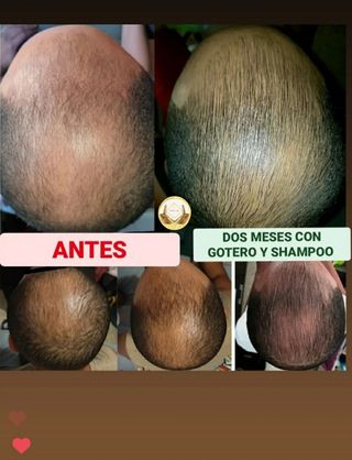 -Terapeuta holistica, física y estética