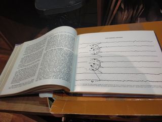 Libro de medicina, electroencefalogra