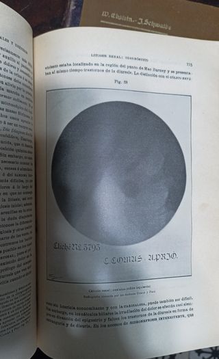 PATOLOGÍA MÉDICA Y TERAPÉUTICA. ZIEMSSEN. (22)