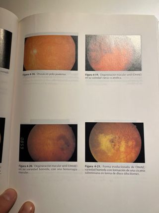 Libro guiones de Oftalmología. JC Pastor Jimeno