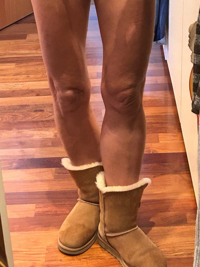 stivali Ugg con pelo