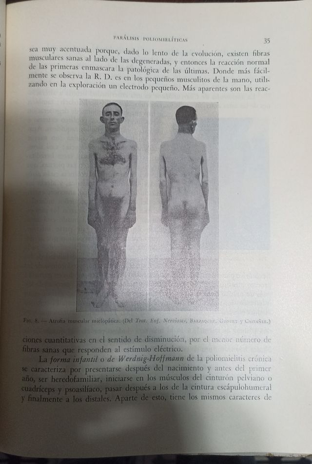 Las Parálisis (LB43)