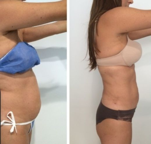 Te garantizo resultados