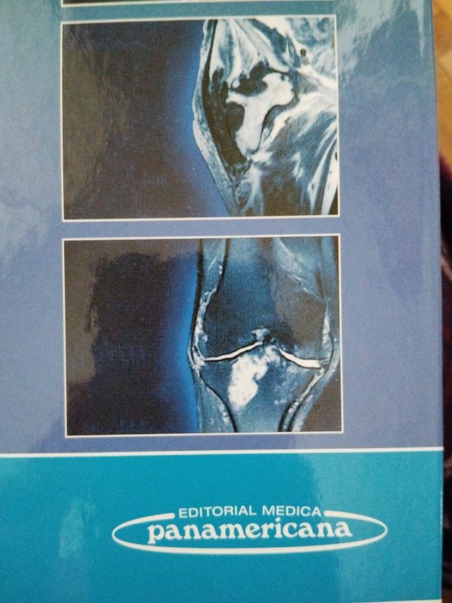 RMN músculoesquelética