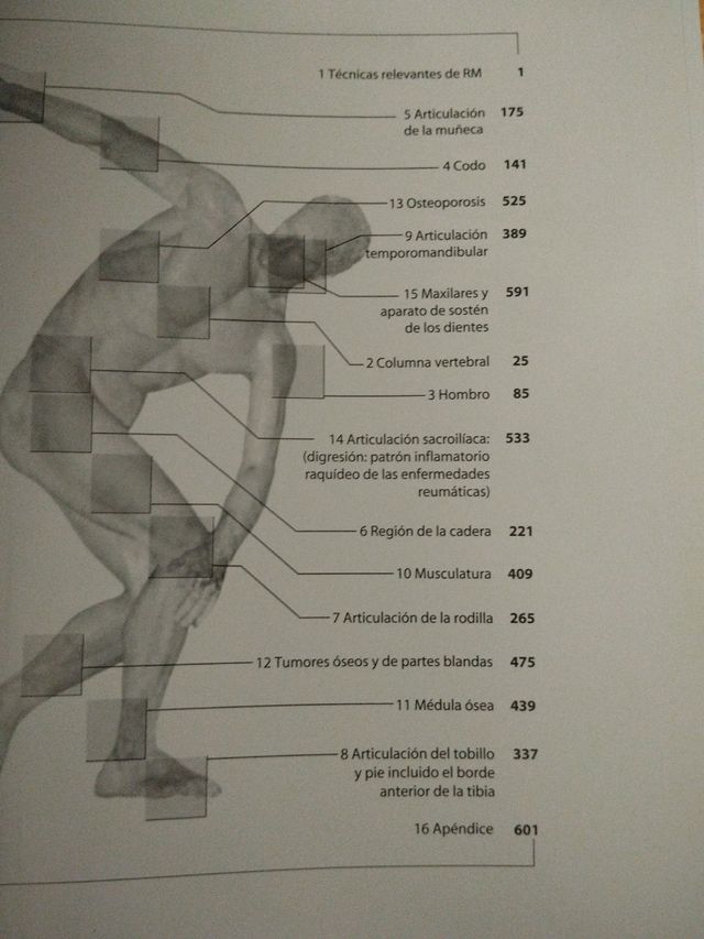 RMN músculoesquelética