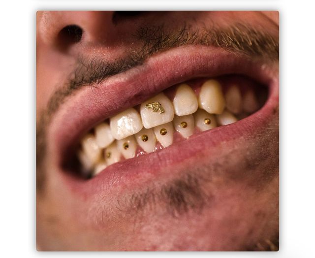 GEMAS DENTALES JOYAS SWAROVSKI 💎✨