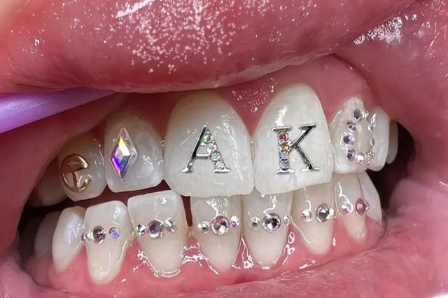 GEMAS DENTALES JOYAS SWAROVSKI 💎✨