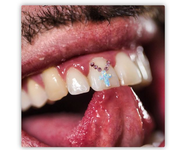 GEMAS DENTALES JOYAS SWAROVSKI 💎✨