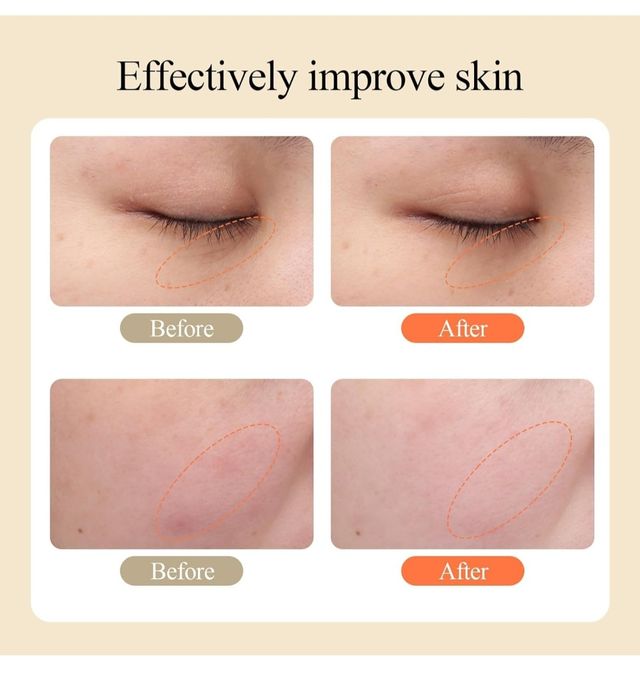 TOUCHBeauty Terapia de luz LED.