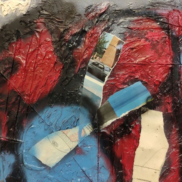 "FIBROADENOMA" dipinto astratto (Crocevia Studio)