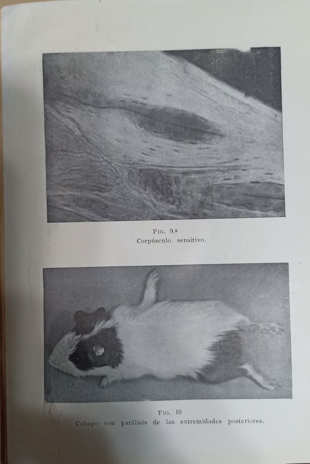 Nuevas adquisiciones sobre Poliomielitis (39)