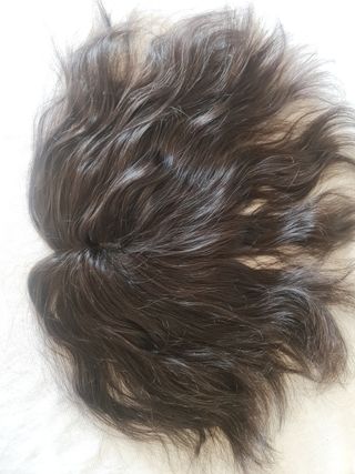 Fabrico de prótesis frontal