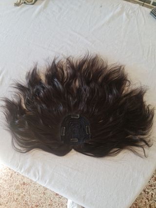 Fabrico de prótesis frontal