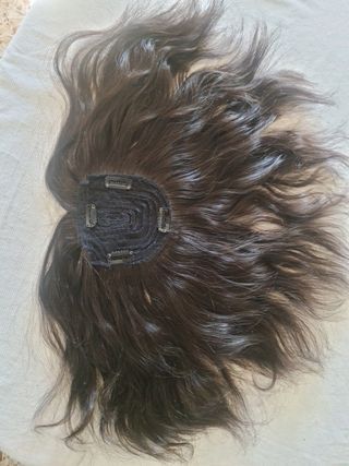 Fabrico de prótesis frontal