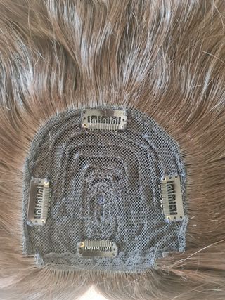 Fabrico de prótesis frontal