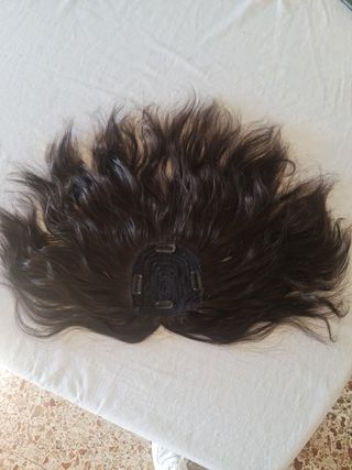 Fabrico de prótesis frontal