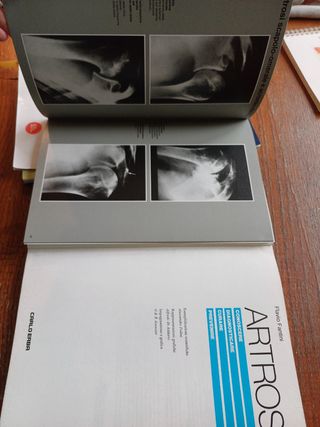 Trattato medico sull'artrosi