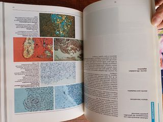 Trattato medico sull'artrosi