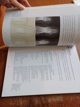 Trattato sull'imagin osteo-articolare