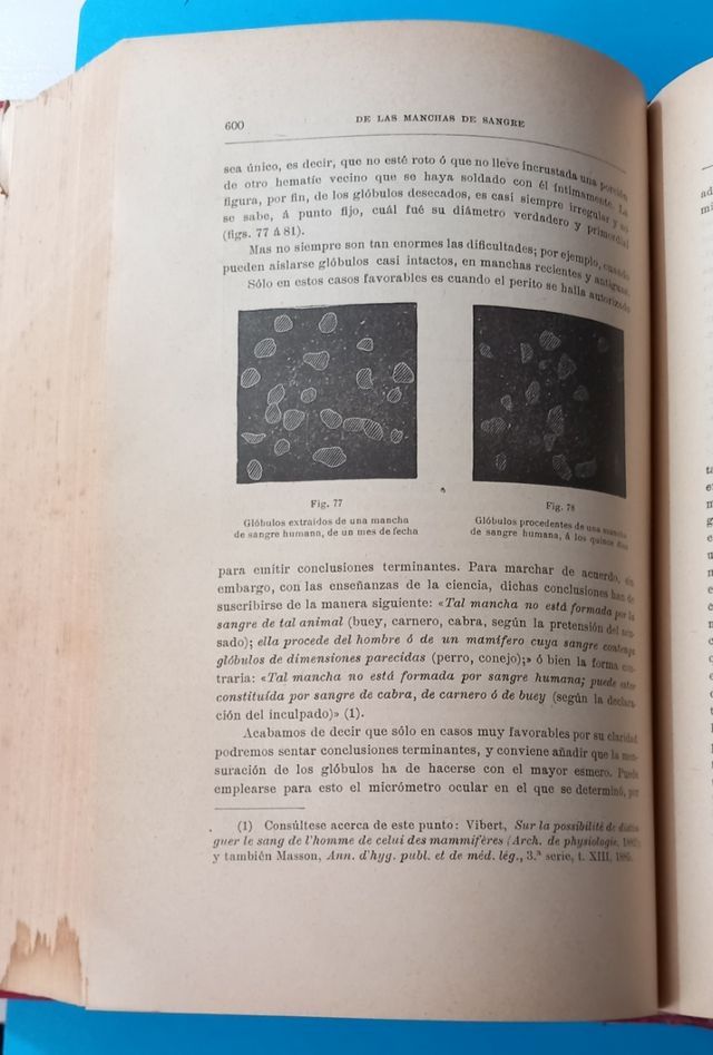 Tratado antiguo medicina legal