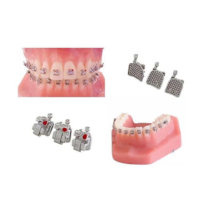 Soporte autoligante de Metal para ortodoncia
