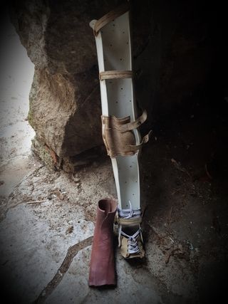 Gabinete de curiosidades antigua órtosis infantil