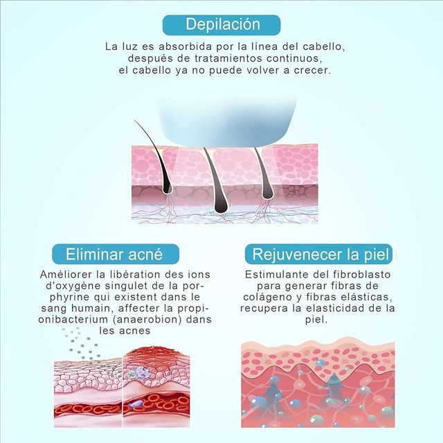 Depiladora IPL yelimina acné