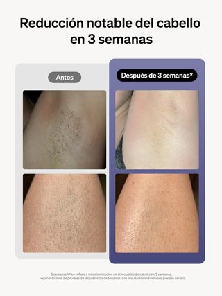 Ulike Depiladora Láser IPL Air 3 NUEVA