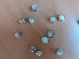 Gemelos de piedras