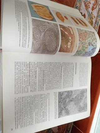 Anatomía e histología patológica