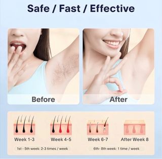 Depiladora IPL Eliminación Permanente del Vello