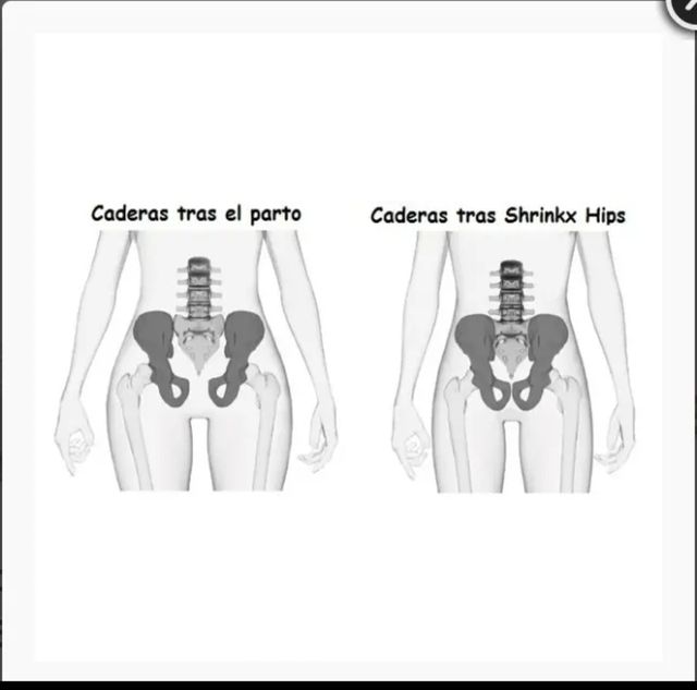 Cinturón pélvico/postparto