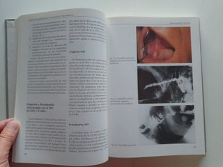 Infecciones Orofaciales Diagnóstico y Tratamientos