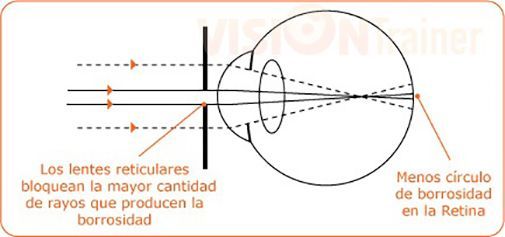 Gafas para Corregir Miopía astigmatismo presbicia