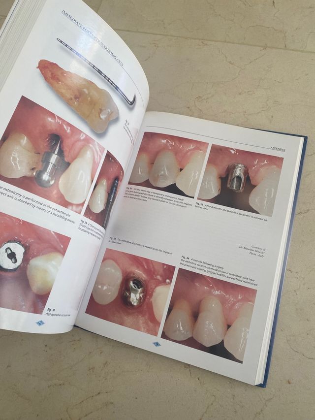 Libro immediate implant extraction Corrente