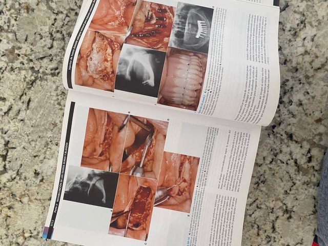 Libro implantologia contemporanea Carl E Misch