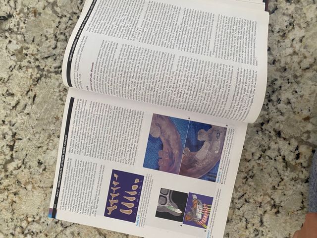 Libro implantologia contemporanea Carl E Misch