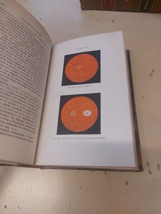 Libro antiguo Enfermedades de los ojos