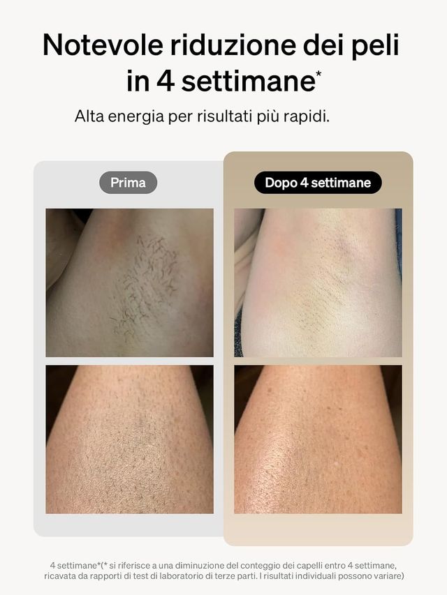 Ulike Air+ Epilatore a Luce Pulsata Uomo/Donna