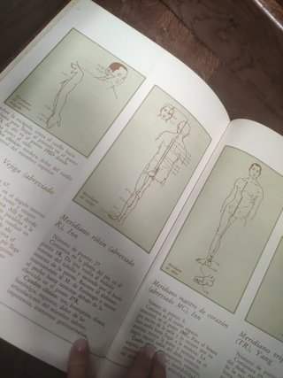 La acupuntura de Medicina Natural